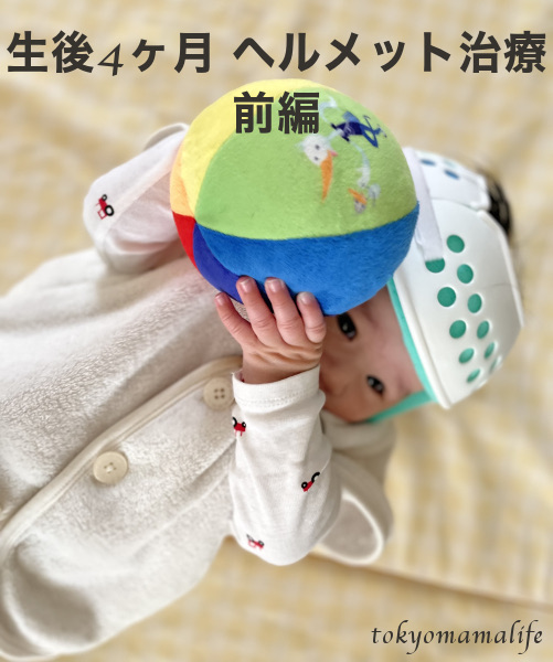 赤ちゃんヘルメット治療